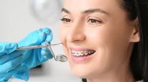 Orthodontics - Best Dental Solutions in Jaipur | Dental World Jaipur
