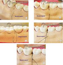 Restorative Dentistry - Best Dental Solutions in Jaipur | Dental World Jaipur